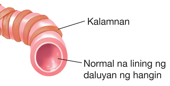 Ang kalamnan at normal lining ng daanan ng hangin (bronchial tube)