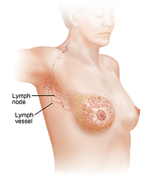 Three-quarter view of female head, neck, and chest with raised right arm showing axillary lymph nodes and vessels.