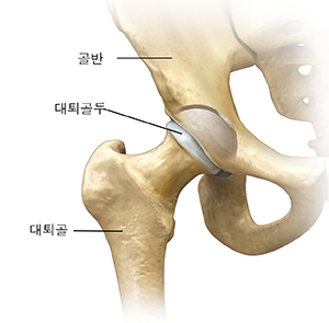 고관절의 전면 모습.