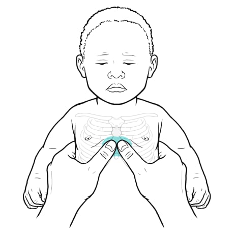Thumbs placed on center of baby's chest with hands wrapped around baby's chest and back.