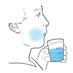 Person holding glass of water and swishing water in mouth.