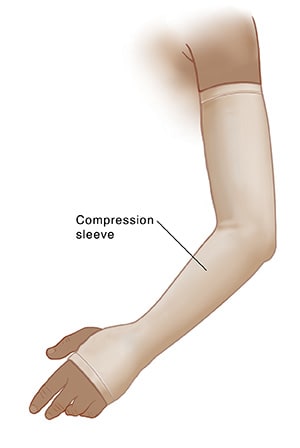 Arm with compression sleeve.
