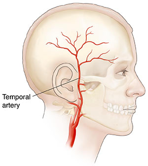 Side view of head showing temporal artery.