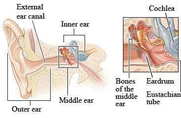 Anatomy of ear, showing outer ear, external ear canal, middle ear, and inner ear, with detail of middle ear bones, eardrum, cochlea, and eustachian tube.