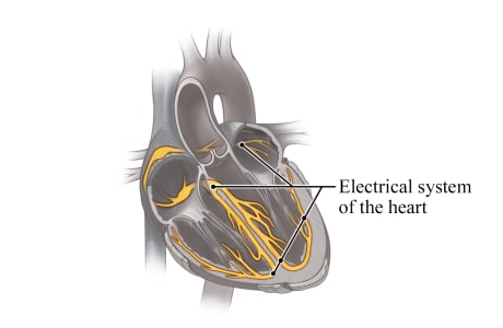 Cross section of the heart, showing the electrical system.