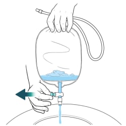 One hand holding top of catheter bag over toilet with other hand pulling out valve to open it and soapy water flowing from bag into toilet.
