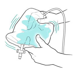 Hands holding catheter bag with cleaning solution inside while shaking bag.