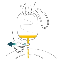 One hand holding top of catheter bag over toilet, with other hand pulling valve out to open it, and urine flowing from bag into toilet.