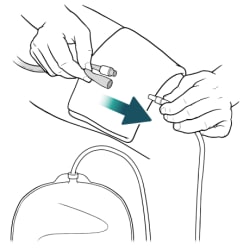 One hand holding catheter, with other hand pulling bag tube away from catheter opening.
