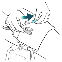One hand holding catheter and leg bag drainage tube, with other hand removing drainage tube cover.