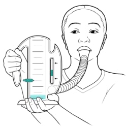 Person holding incentive spirometer, with lips closed around mouthpiece.