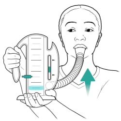 Person holding incentive spirometer, with lips closed around mouthpiece and arrow showing person inhaling.