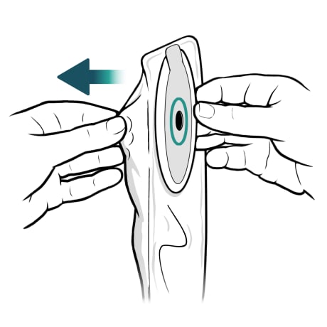 One hand holding ostomy bag from front, while other hand peels back of bag away.