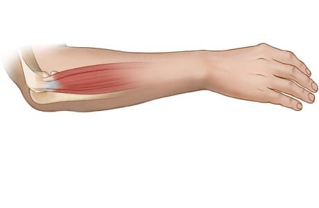 Elbow.