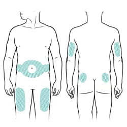 A person’s front and back, with highlighted areas where insulin can be injected, including area around belly button, front of waist, upper thighs, upper buttocks near hips, and back of upper arms.
