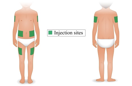Child's body, showing injection sites on thigh, back of upper arm, and belly at least 2 inches to side of belly button.