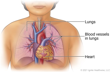 Inside person's chest, showing heart, blood vessels, lungs, and blood vessels in lungs.