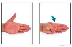 Thumb flexion and extension