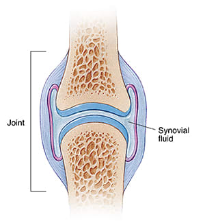 Cross section of healthy joint showing joint capsule and synovial fluid.