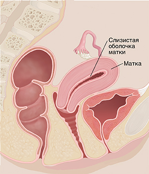 Поперечное сечение таза женщины сбоку: показаны матка и слизистая оболочка матки.