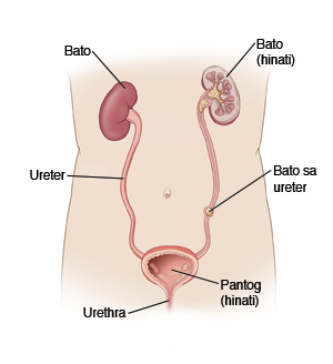 Larawan ng mga tahi, steri-strips, pandikit (glue), at staples sa pagsasara ng sugat.