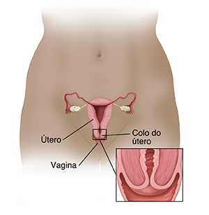 Vista frontal da pélvis feminina, mostrando um corte transversal do útero, ovários, colo do útero, vagina e tubas uterinas. O detalhe mostra um corte transversal aumentado do colo do útero.