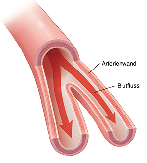 Querschnitt einer Halsschlagader zur Veranschaulichung des Blutflusses.
