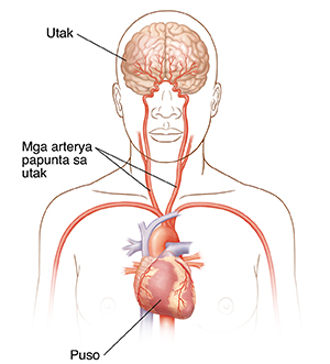 Harapang kuha ang ulo at itaas ng katawan na ipinakikita ang mga carotid artery (ang pangunahing mga ugat ng dugo sa leeg), puso, at utak.