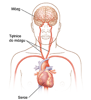 Widok głowy i górnej części ciała od przodu pokazujący tętnice szyjne, serce i mózg.