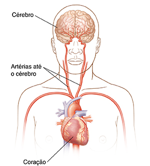 Vista frontal da cabeça e parte superior do corpo mostrando as artérias carótidas, o coração e o cérebro.