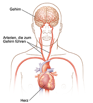 Vorderansicht von Kopf und Oberkörper mit Halsschlagadern, Herz und Gehirn.
