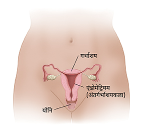 गर्भाशय के अंदर एंडोमेट्रियम परत को दर्शाता हुआ गर्भाशय और योनि के क्रॉस सेक्शन का सामने का दृश्य।
