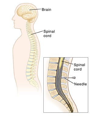 Illustration showing the spinal cord