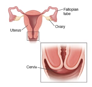 Uterus, fallopian tubes, ovaries, and cervix, with inset showing a close-up of cervix.