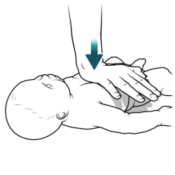 Baby lying on back, with heel of person's hand pushing down on baby’s chest.
