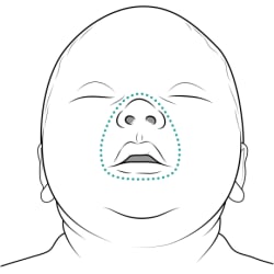 Close-up of baby’s face with dotted line around mouth and nose, showing area for rescue breaths.