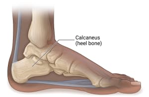 Side view of foot and ankle bones, with label for calcaneus or heel bone.