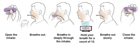 Six steps in using a diskus dry powder inhaler.