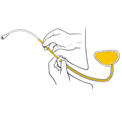 Person pushing catheter into penis until catheter reaches full bladder and urine flows into catheter.