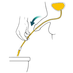 Person holding catheter toward toilet, with arrow showing urine flowing out of full bladder, through catheter, and into toilet.