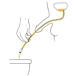 Person holding catheter toward toilet with urine flowing out of bladder, through catheter, and into toilet.