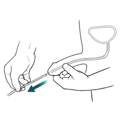 Person pulling catheter out of penis with one hand and holding penis with other hand.