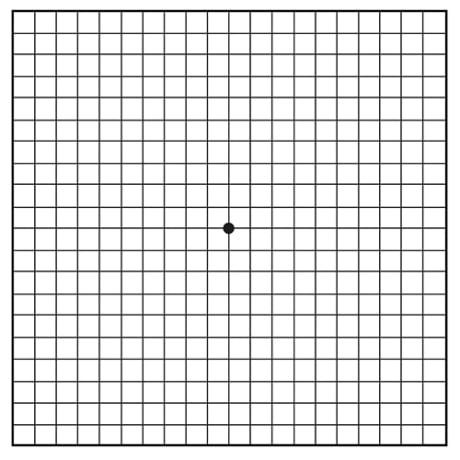 Amsler grid of black lines forming small squares and black dot in the center.