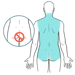 Person's back side of neck, back, and rear end highlighted, with inset image of rectal area inside prohibition symbol.