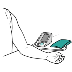 Person’s arm resting on flat surface with palm facing up and blood pressure monitor and cuff close by.