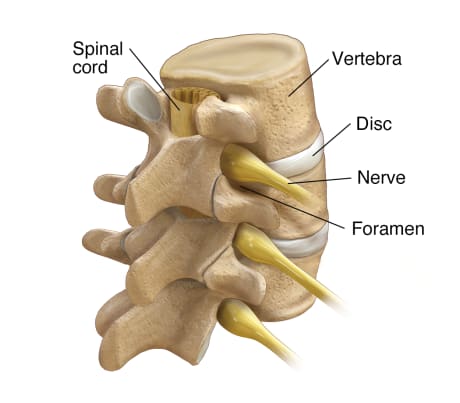 Three lumbar vertebrae, showing spinal cord in spinal column, and discs, nerves, and foramen.