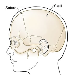 Side view of child's head showing skull.