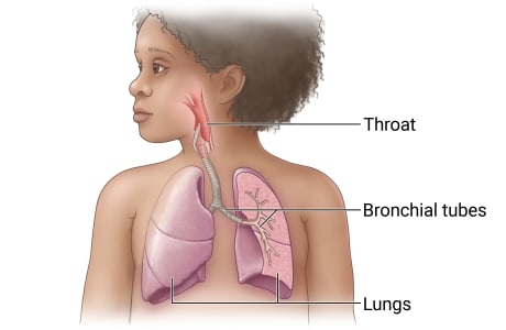 Respiratory system in child, showing throat connected to bronchial tubes which lead to lungs in chest.