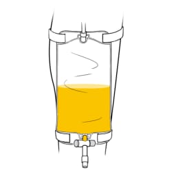 Leg catheter bag fastened to lower leg, with bag half full of urine.
