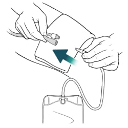 One hand holding bag tube with other hand holding catheter opening and arrow showing bag tube going into catheter opening.